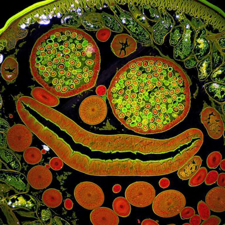 Image microscopique en coupe d'un Ascaris femelle, dont les motifs circulaires colorés évoquent des formes reconnaissables